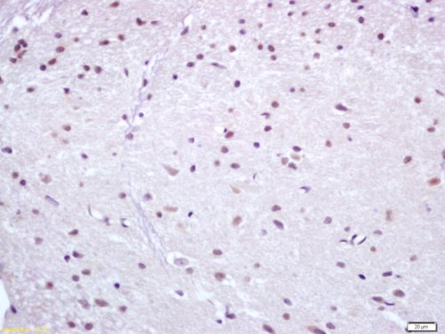 Immunohistochemistry (Formalin/PFA-fixed paraffin-embedded sections) - Anti-NUR77 antibody (AB217547)