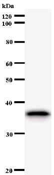 Western blot - Anti-Nurr1 antibody [447C2a] (AB54366), expandable thumbnail