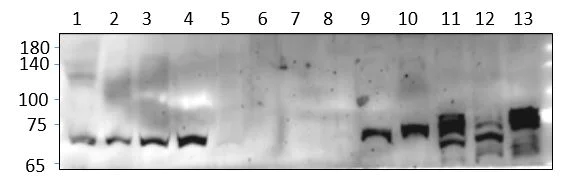 Western blot - Anti-Nurr1 antibody (AB176184)