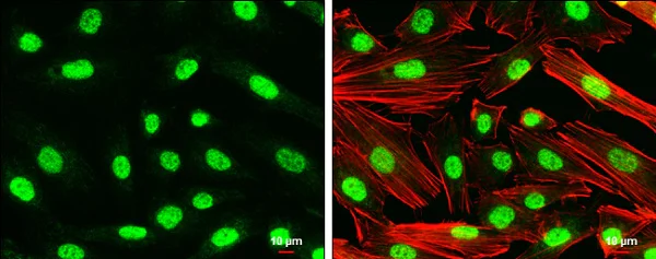 Immunocytochemistry/ Immunofluorescence - Anti-Nurr1 antibody (AB227260)
