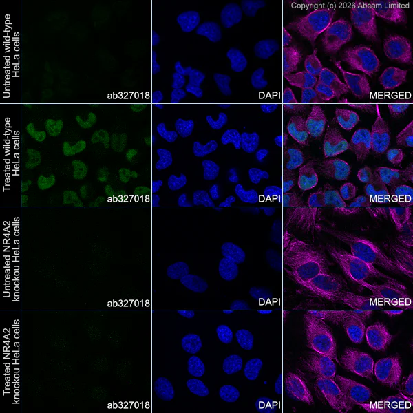Immunocytochemistry/ Immunofluorescence - Anti-Nurr1 antibody [EPR26338-73] (AB327018)