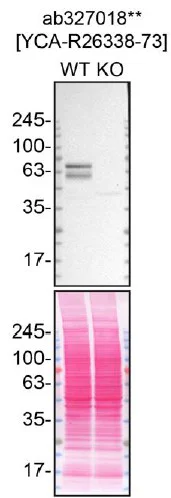 Western blot - Anti-Nurr1 antibody [EPR26338-73] (AB327018)