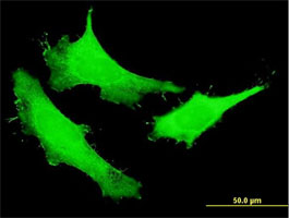 Immunocytochemistry/ Immunofluorescence - Anti-NUSAP antibody (AB169083), expandable thumbnail
