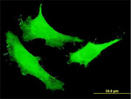 Immunocytochemistry/ Immunofluorescence - Anti-NUSAP antibody (AB169083)