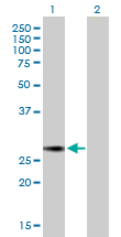 Western blot - Anti-NUSAP antibody (AB169083), expandable thumbnail