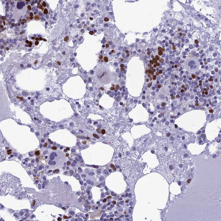 Immunohistochemistry (Formalin/PFA-fixed paraffin-embedded sections) - Anti-NUSAP antibody (AB247043)