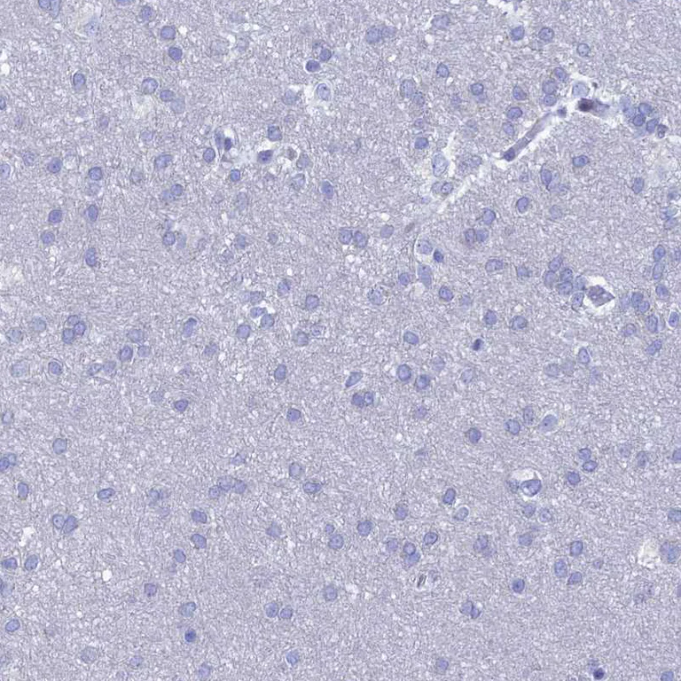 Immunohistochemistry (Formalin/PFA-fixed paraffin-embedded sections) - Anti-NUSAP antibody (AB247043)