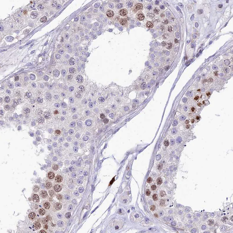 Immunohistochemistry (Formalin/PFA-fixed paraffin-embedded sections) - Anti-NUSAP antibody (AB247043)
