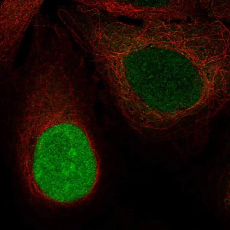 Immunocytochemistry/ Immunofluorescence - Anti-NUSAP1 Antibody (AB327280)