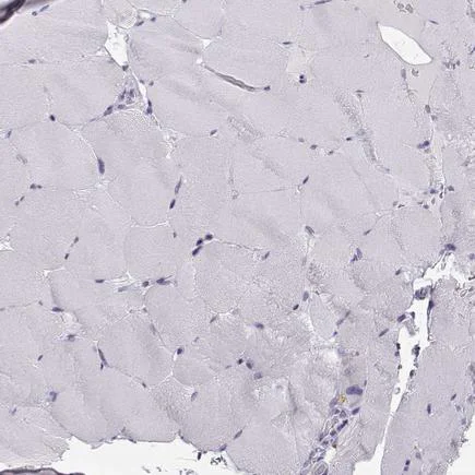 Immunohistochemistry (Formalin/PFA-fixed paraffin-embedded sections) - Anti-NUT antibody (AB122649)