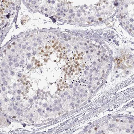 Immunohistochemistry (Formalin/PFA-fixed paraffin-embedded sections) - Anti-NUT antibody (AB122649)