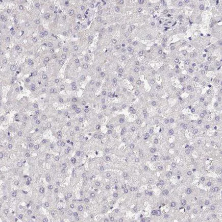 Immunohistochemistry (Formalin/PFA-fixed paraffin-embedded sections) - Anti-NUT antibody (AB122649)