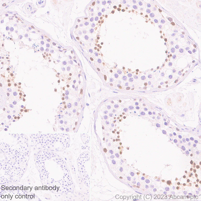 Immunohistochemistry (Formalin/PFA-fixed paraffin-embedded sections) - Anti-NUT antibody [EPR28221-46] (AB315460)