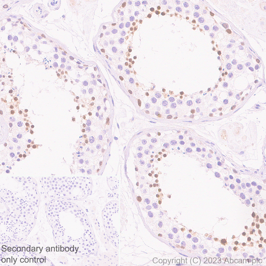 Immunohistochemistry (Formalin/PFA-fixed paraffin-embedded sections) - Anti-NUT antibody [EPR28221-46] - BSA and Azide free (AB315461), expandable thumbnail