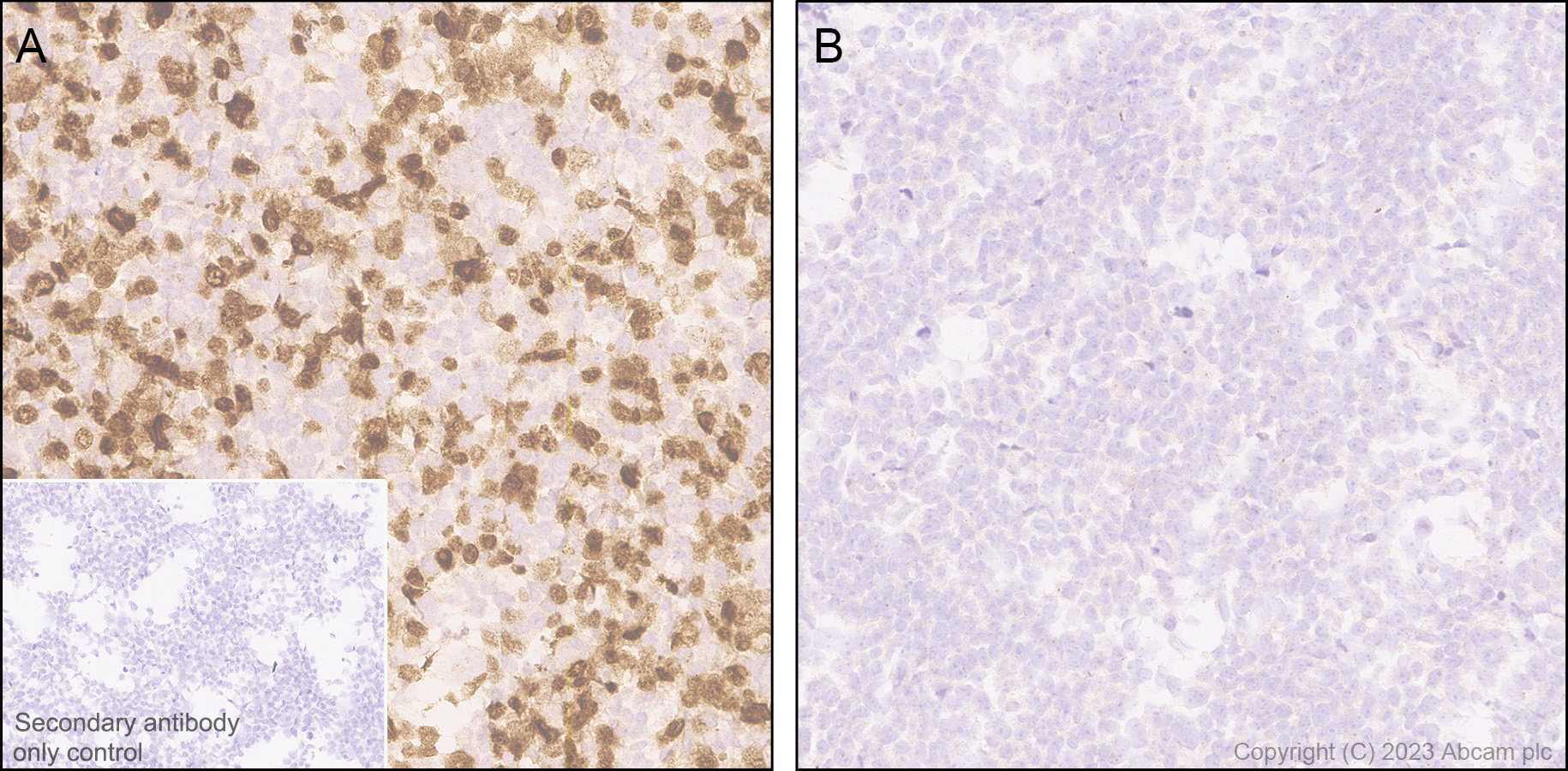 Immunohistochemistry (Formalin/PFA-fixed paraffin-embedded sections) - Anti-NUT antibody [EPR28221-46] - BSA and Azide free (AB315461), expandable thumbnail