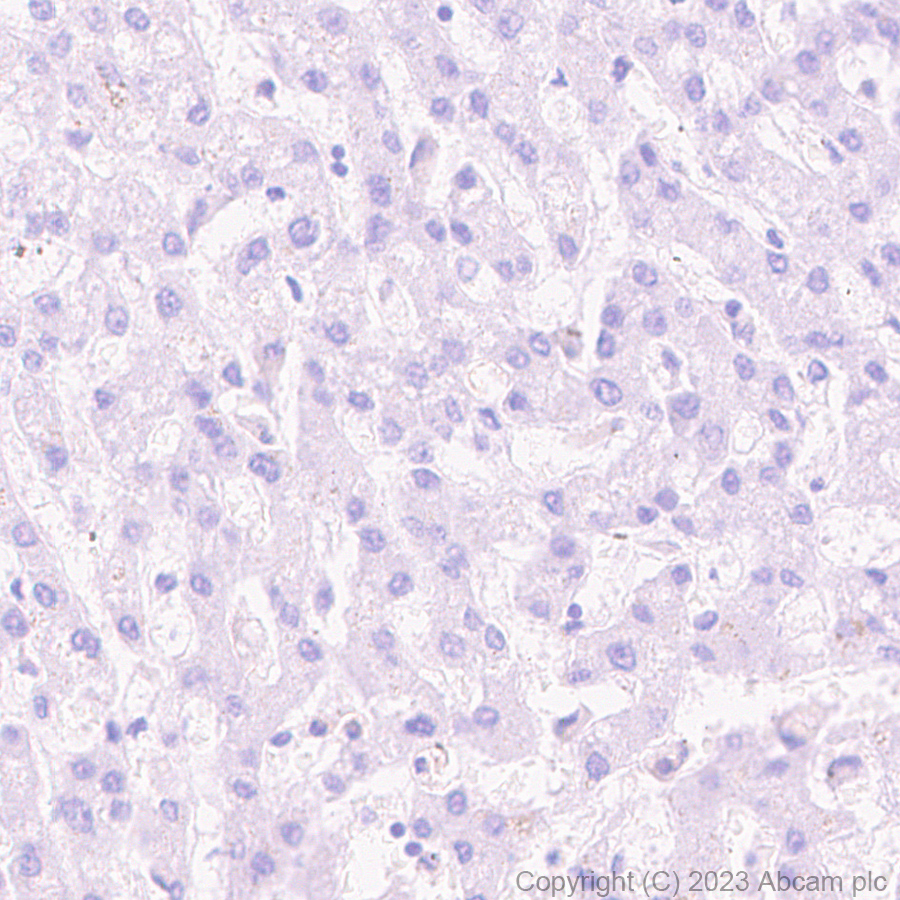 Immunohistochemistry (Formalin/PFA-fixed paraffin-embedded sections) - Anti-NUT antibody [EPR28221-46] - BSA and Azide free (AB315461), expandable thumbnail