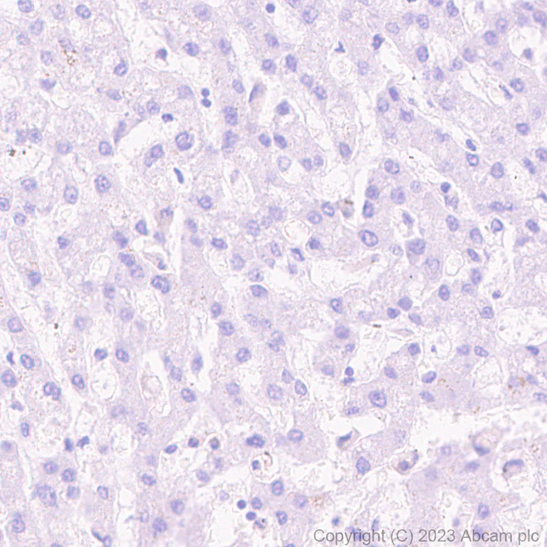 Immunohistochemistry (Formalin/PFA-fixed paraffin-embedded sections) - Anti-NUT antibody [EPR28221-46] - BSA and Azide free (AB315461)