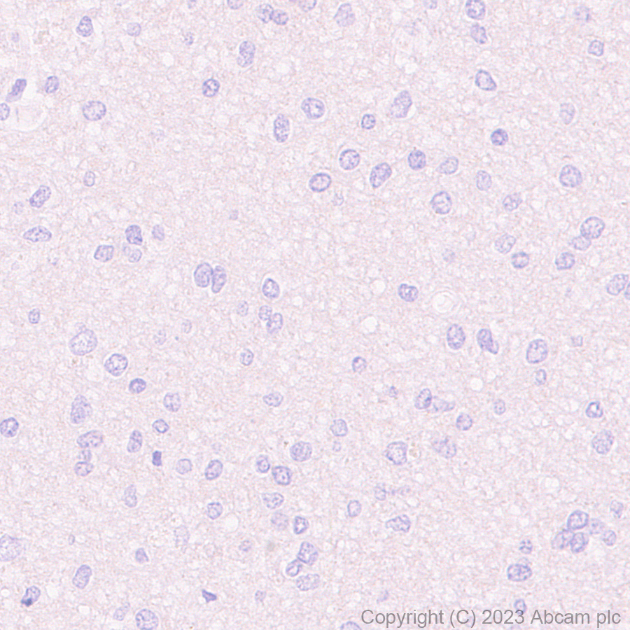 Immunohistochemistry (Formalin/PFA-fixed paraffin-embedded sections) - Anti-NUT antibody [EPR28221-46] - BSA and Azide free (AB315461), expandable thumbnail