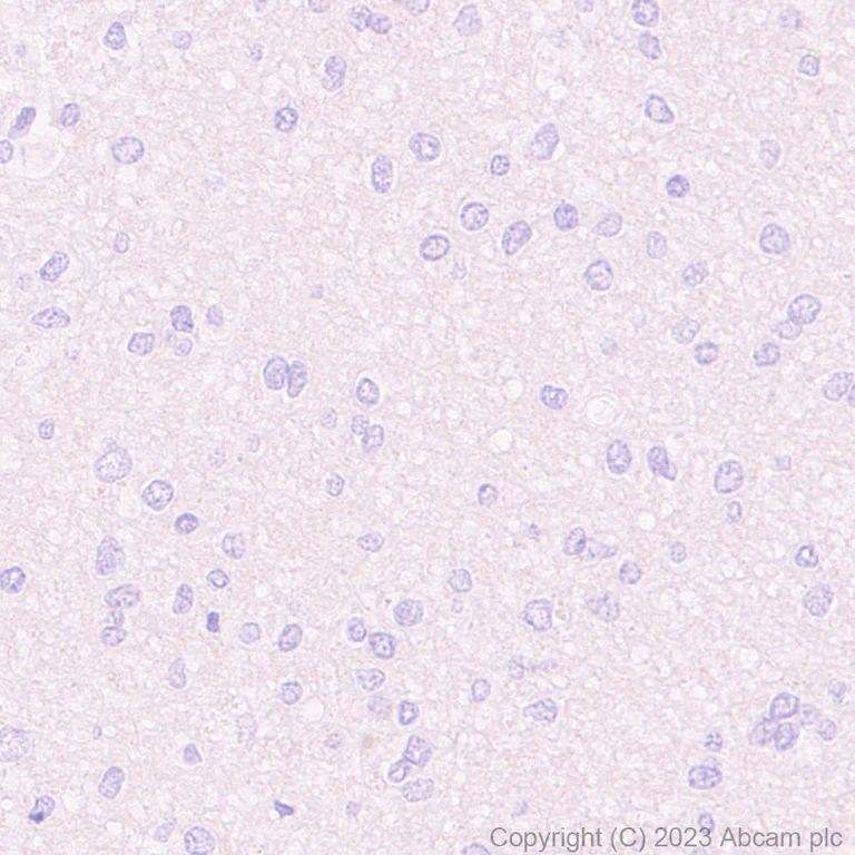 Immunohistochemistry (Formalin/PFA-fixed paraffin-embedded sections) - Anti-NUT antibody [EPR28221-46] - BSA and Azide free (AB315461)