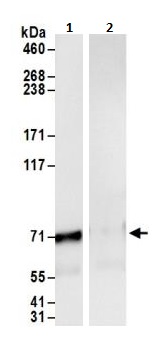 Immunoprecipitation - Anti-NXF1 antibody (AB264341), expandable thumbnail