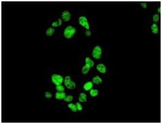 Immunocytochemistry/ Immunofluorescence - Anti-NXF1 antibody [EPR8009] (AB129160)
