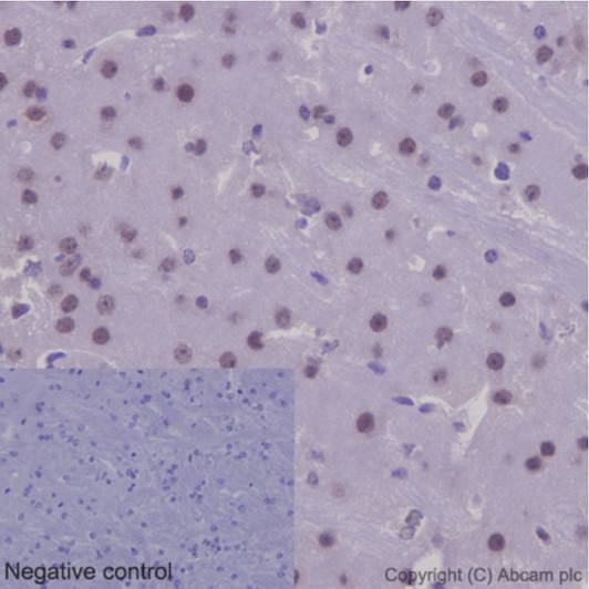Immunohistochemistry (Formalin/PFA-fixed paraffin-embedded sections) - Anti-NXN/NRX antibody [EPR15177] (AB191429), expandable thumbnail
