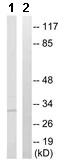 Western blot - Anti-NXPH1 antibody (AB167039)