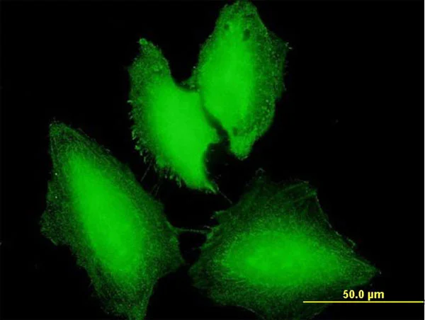 Immunocytochemistry/ Immunofluorescence - Anti-NXT1 antibody (AB168481)