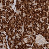 Immunohistochemistry (Formalin/PFA-fixed paraffin-embedded sections) - Anti-NXT2 antibody (AB121797)