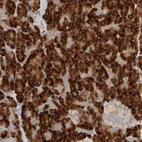 Immunohistochemistry (Formalin/PFA-fixed paraffin-embedded sections) - Anti-NXT2 antibody (AB121797)