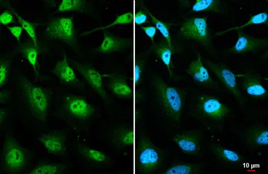 Immunocytochemistry/ Immunofluorescence - Anti-O-GlcNAc transferase antibody [HL1641] (AB308178)