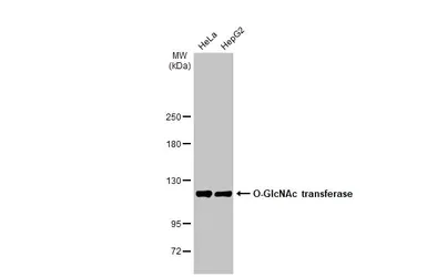 Western blot - Anti-O-GlcNAc transferase antibody [HL1641] (AB308178)