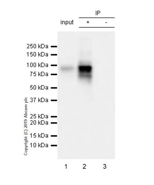 Immunoprecipitation - Anti-O-Linked N-Acetylglucosamine antibody [EPR19847] (AB202665)