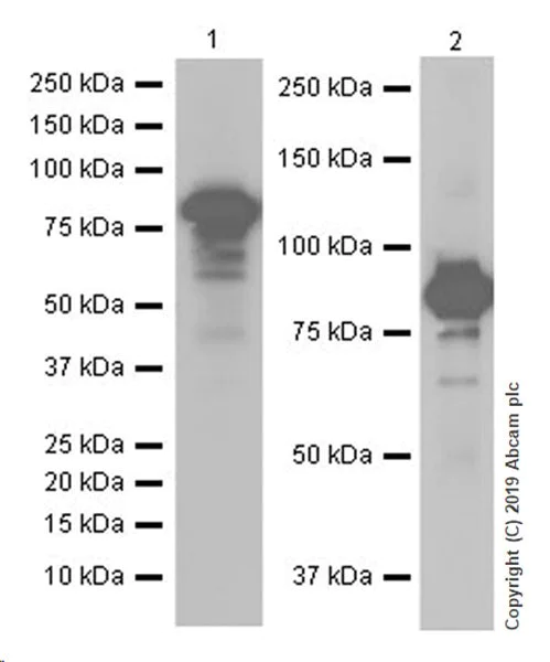 Western blot - Anti-O-Linked N-Acetylglucosamine antibody [EPR19847] (AB202665)