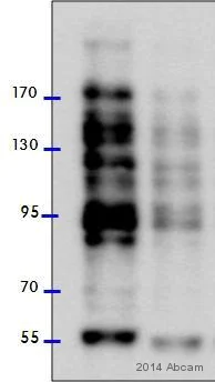 Western blot - Anti-O-Linked N-Acetylglucosamine antibody [RL2] (AB2739)