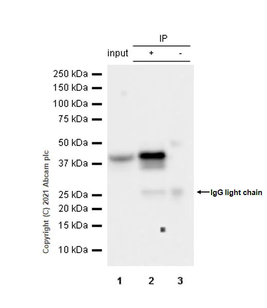 Immunoprecipitation - Anti-OAS1 antibody [EPR24824-162] (AB272492)