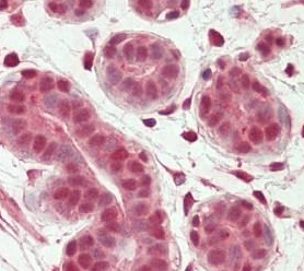 Immunohistochemistry (Formalin/PFA-fixed paraffin-embedded sections) - Anti-OAS2 antibody (AB195968), expandable thumbnail