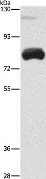 Western blot - Anti-OAS2 antibody (AB197655)
