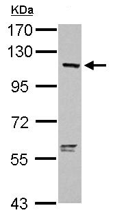 Western blot - Anti-OAS3 antibody (AB154270), expandable thumbnail