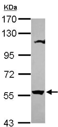 Western blot - Anti-OASL antibody (AB155422)