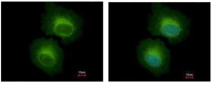 Immunocytochemistry/ Immunofluorescence - Anti-OASL antibody (AB229136)