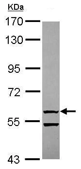 Western blot - Anti-OASL antibody (AB229136)