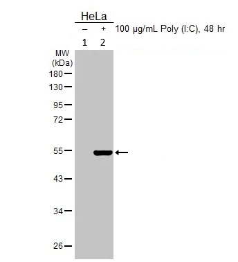 Western blot - Anti-OASL antibody (AB229136)