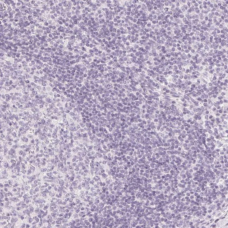 Immunohistochemistry (Formalin/PFA-fixed paraffin-embedded sections) - Anti-OAT3 antibody (AB247055)