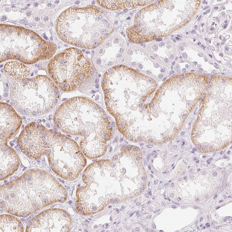 Immunohistochemistry (Formalin/PFA-fixed paraffin-embedded sections) - Anti-OAT3 antibody (AB247055), expandable thumbnail