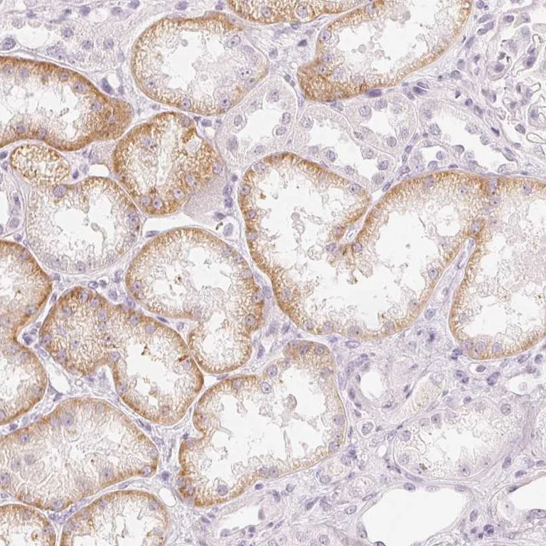 Immunohistochemistry (Formalin/PFA-fixed paraffin-embedded sections) - Anti-OAT3 antibody (AB247055)