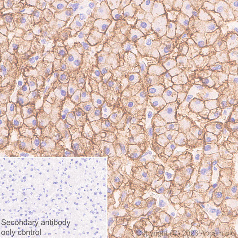 Immunohistochemistry (Formalin/PFA-fixed paraffin-embedded sections) - Anti-OATP1B1 antibody [EPR27070-49] (AB312838)