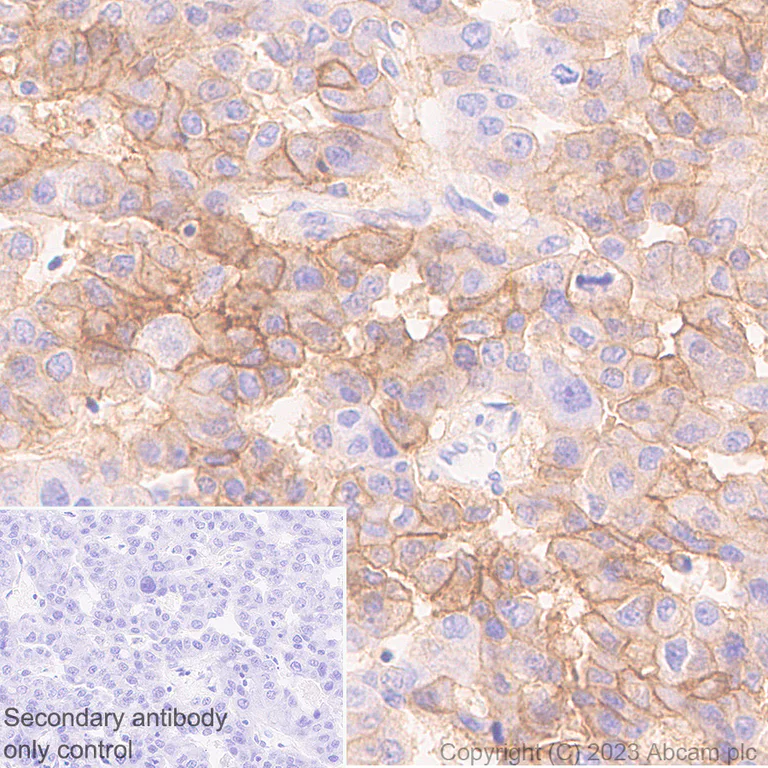 Immunohistochemistry (Formalin/PFA-fixed paraffin-embedded sections) - Anti-OATP1B1 antibody [EPR27070-49] (AB312838)