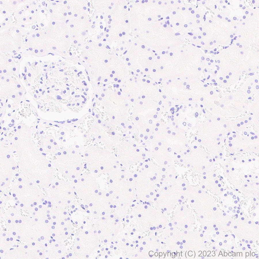 Immunohistochemistry (Formalin/PFA-fixed paraffin-embedded sections) - Anti-OATP1B1 antibody [EPR27070-49] (AB312838)