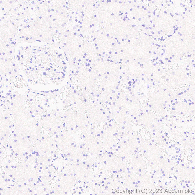 Immunohistochemistry (Formalin/PFA-fixed paraffin-embedded sections) - Anti-OATP1B1 antibody [EPR27070-49] (AB312838)